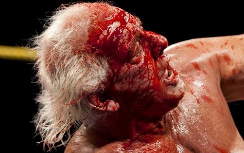 Ric+Flair-Bleeding.jpg