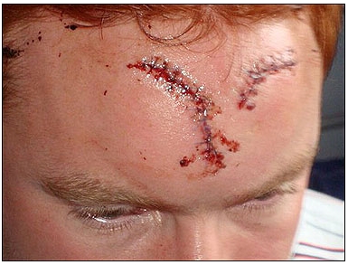 UK Soft justice: How thugs can batter victims like this and get a caution thumbnail